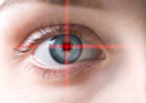 LASIK